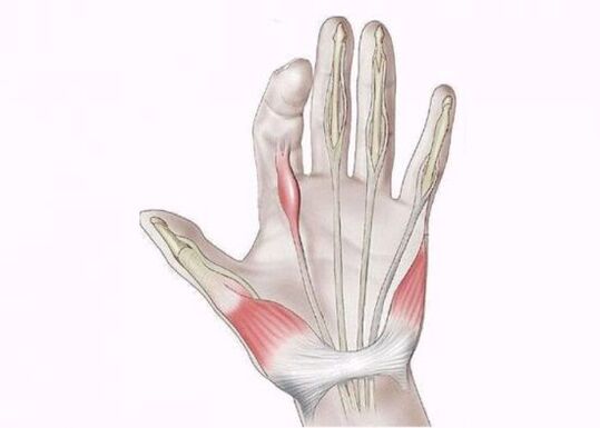 inflammation of tendons as a cause of finger joint pain