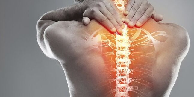 Medical options for cervical therapy of cervical osteochondrosis